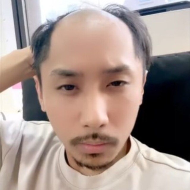 ウィッグを外したノゾエさん／かつらニキ（ノゾエタカシ）さん（@katsuraniki）提供