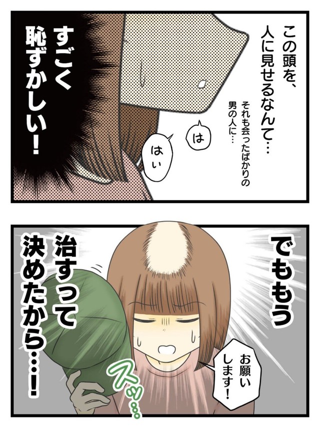 【漫画】『女だけど坊主にしました。〜13年間悩み続けた抜毛症が治るまで〜』7（春乃おはなさん提供）