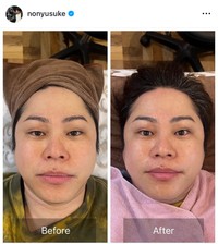 井上裕介（@nonyusuke）さんのインスタグラムより