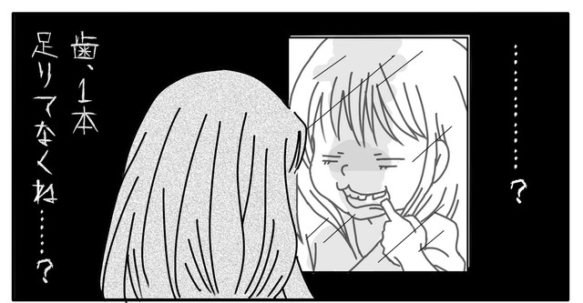 手術前より歯が減った？（種真希さん提供）