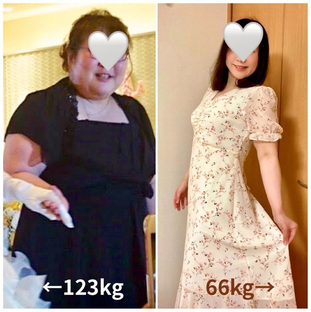 123kgの頃と66kgに減量した現在。大幅な変化を遂げた姿が話題に／ひさなさん（@hisana_diet）提供