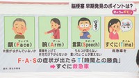 誰でも起こりうる脳梗塞　早期発見が大切