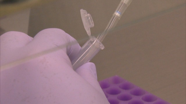 香川県で6人の感染を確認　4人が高松市でいずれも中等症〈新型コロナ〉