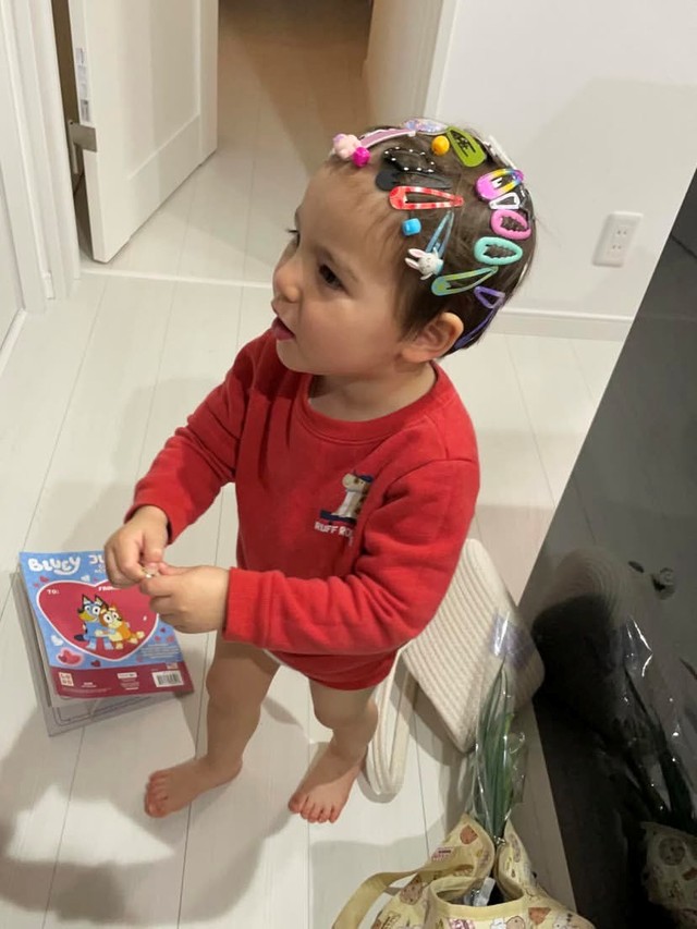 頭中にヘアピン！ （ YUIKA NEEEEEEさん　提供）