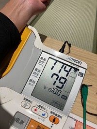 一般的な血圧の目安は「125/75mmHg未満」とされる