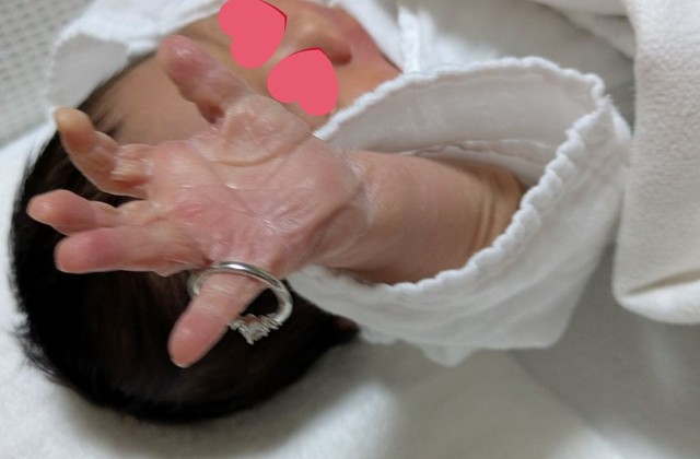 生後間もなくの頃から、すでにますかけ線が確認できます。 ※最中もなかさん提供