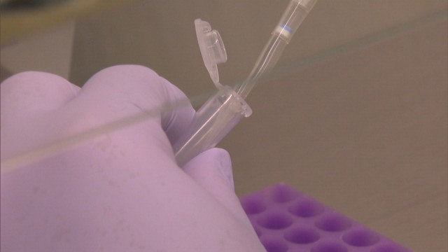 香川県で新たに127人が感染〈新型コロナ〉