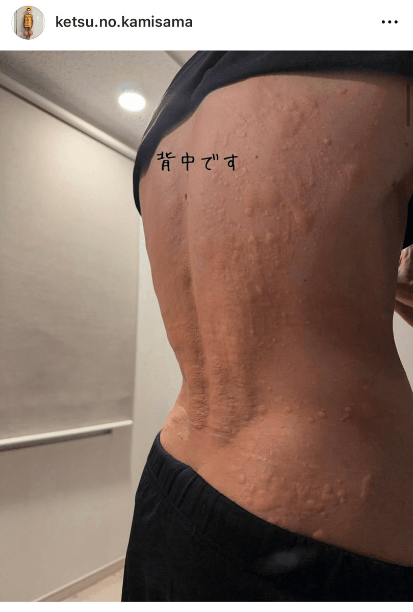 樽美酒研二（今年45歳） (@ketsu.no.kamisama)さんのインスタグラムより