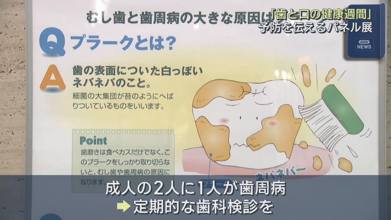 成人２人に１人が歯周病　予防の大切さ伝えるパネル展　宮城県庁