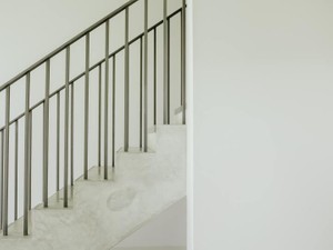 大人の階段を上っていると、いつからか悲しくて痛い。でも、私は上る