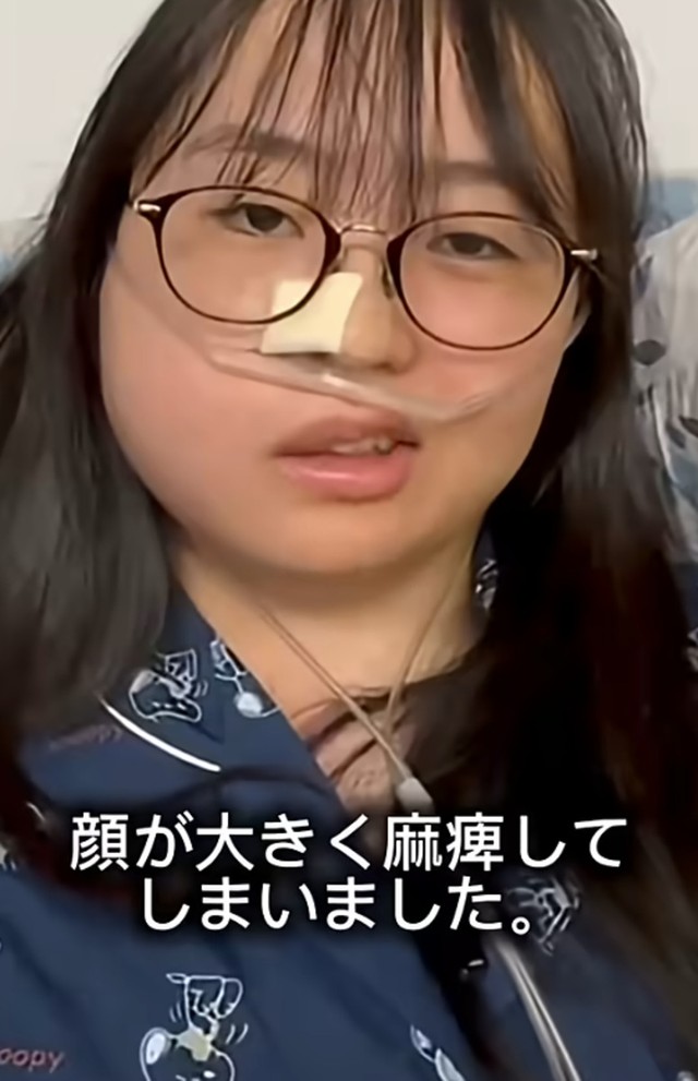 脚から筋肉や脂肪を移植する大きな手術後は顔が大きく麻痺してしまったそう／うーたんさん提供