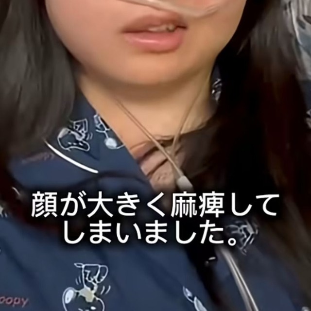 脚から筋肉や脂肪を移植する大きな手術後は顔が大きく麻痺してしまったそう／うーたんさん提供