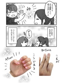 【漫画】『深爪矯正で人生変わった話』4（みりこさん提供）