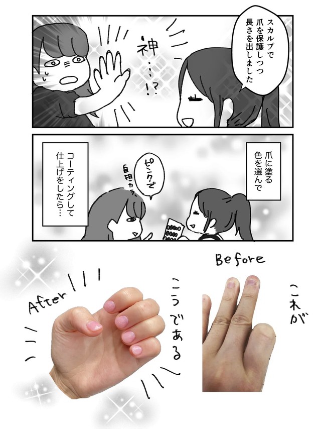【漫画】『深爪矯正で人生変わった話』4（みりこさん提供）