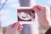 障害のある家族とともに生きてきた妊娠中の女性がつぶやいた投稿が話題に（photoACより「りんどる」さん撮影、イメージ画像）