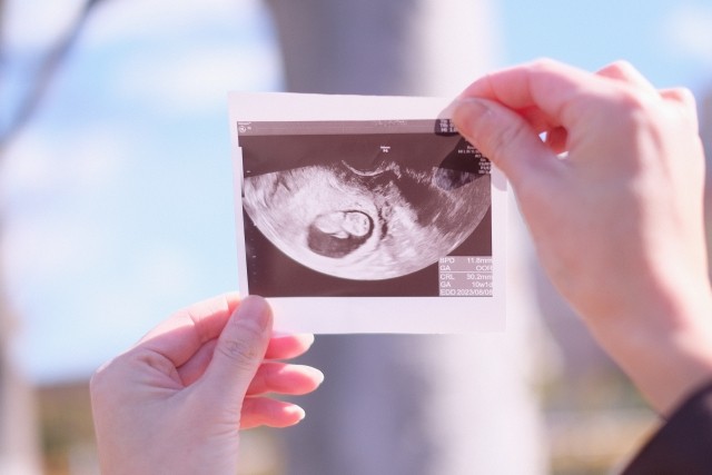障害のある家族とともに生きてきた妊娠中の女性がつぶやいた投稿が話題に（photoACより「りんどる」さん撮影、イメージ画像）
