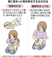 喉に詰まった物を除去する主な方法