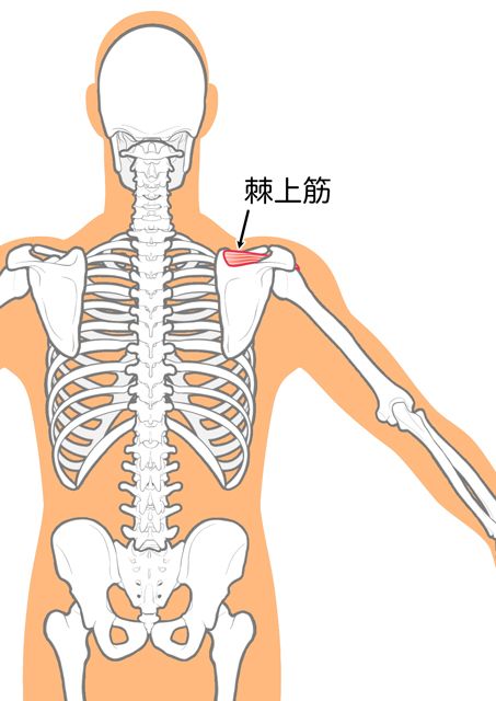 専門家解説】運動していないのに筋肉痛みたいな痛み……原因は病気? 意外 専門家解説】運動していないのに筋肉痛みたいな痛み……原因は病気? 意外