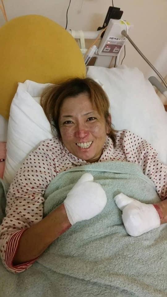 40歳で両指・両足を切断した”指なし筆師” 失ってからは「自分を褒めてきた」 ほ・とせなNEWS