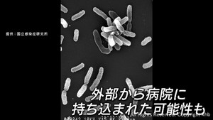 「今までに例がない」宮城・大崎市の病院でのレジオネラ症集団感染に専門家