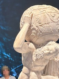 反対側の腕の血管も完璧です（提供：シャントの医ンフルエンサーさん）