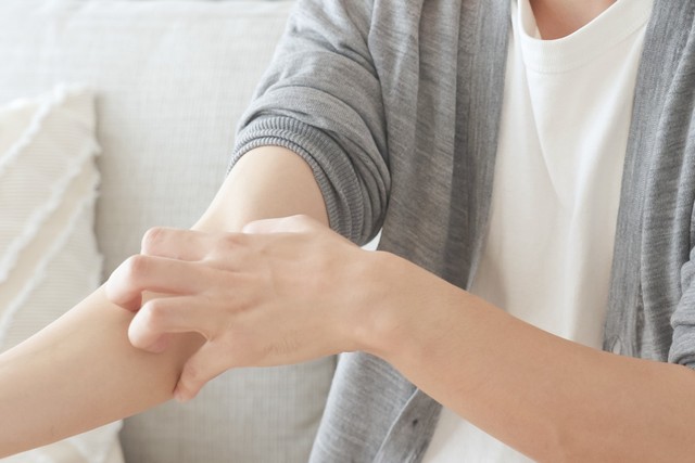 アトピー性皮膚炎患者の8割以上「仕事のストレスによる症状が悪化した」　※画像はイメージです（polkadot/stock.adobe.com）