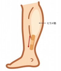 山内流・絆創膏セルフケア（出典：腰痛・肩こり駆け込み寺【山内義弘】 調べ）
