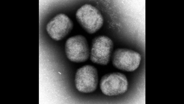 エムポックス（旧サル痘）に30代男性が感染　岡山県初確認