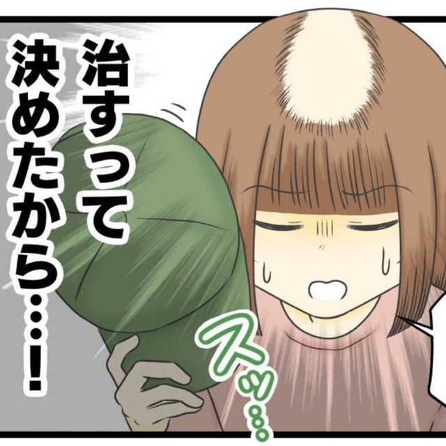 抜毛症を治したい！（春乃おはなさん提供）