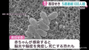 百日せきの感染拡大止まらず　お盆や夏休み時期の基本的な感染予防を呼び掛け