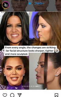 ジョニー・ベタリッジ医師のインスタグラム＠drjb.aestheticsより