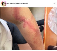 村本大輔（@muramotodaisuke1125）さんのインスタグラムより