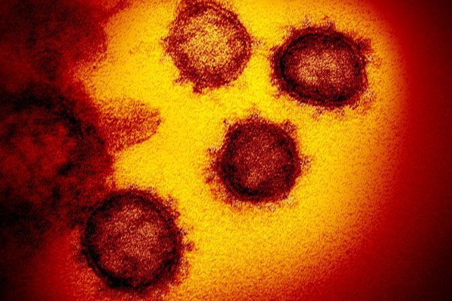 COVID-19 still kills over 30,000 a year in Japan; old people at risk