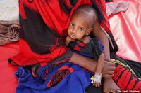 「グローバルヘルス」とは？　世界の健康をめぐる歴史とこれから--}