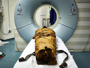 3000年前のミイラの声を再現　３Dプリンターで挑む研究者