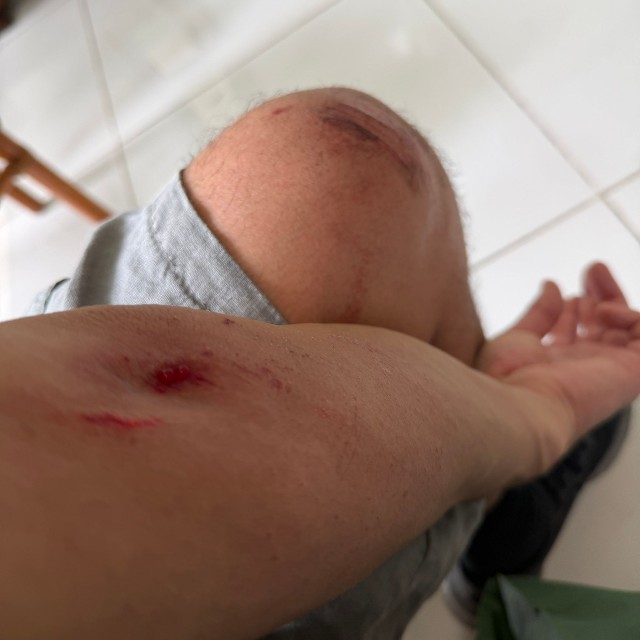 犯人を追いかけた末、路地裏で転倒し傷だらけに／石川貴也さん（@LWITBR1906）提供