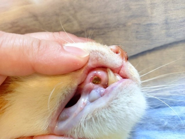 虫歯の箇所