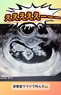 家族全員が驚いた三つ子の妊娠／あすかさん（@asuka_4kids__)提供