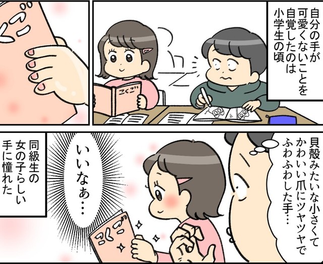 かわいい手に憧れていた…（ユキミさん提供）