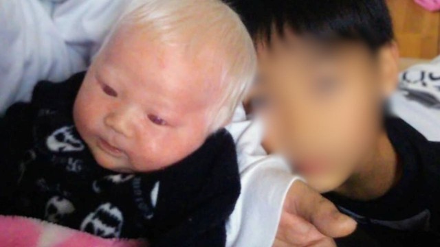 お兄さんとの写真。生まれて間もない頃は心ない言葉をなげかけられたことも多々あった