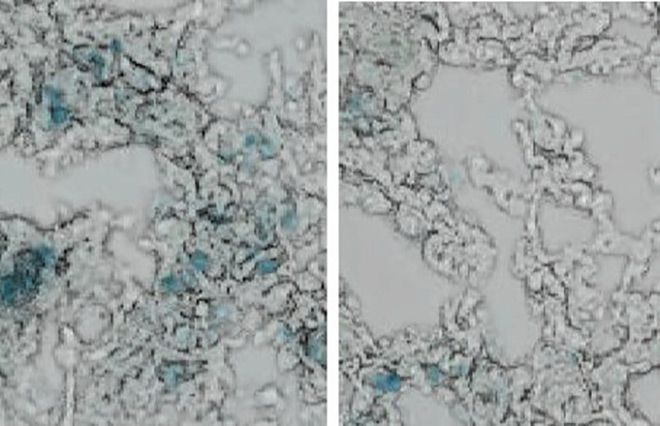 Kyoto team finds drug that kills aging-related cells in mice