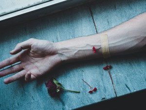 目立つ血管に集まる視線。「気がする」に呪われていた私