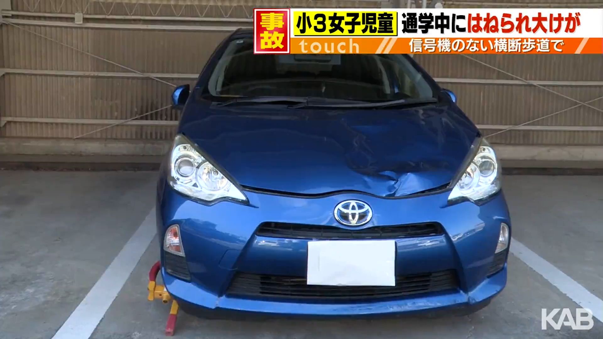 信号のない横断歩道で通学中の小学生が車にはねられ右足を骨折する重傷