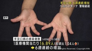 手足口病は６週連続で増加　新型コロナは７週連続で増加　宮城県