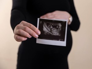 卵子に残機があるって知ってる？選択肢を狭めないためにも知る機会を