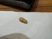 これが下の裏側に数年も入っていたかと思うと衝撃です…！