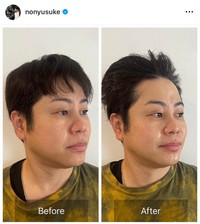 井上裕介（@nonyusuke）さんのインスタグラムより