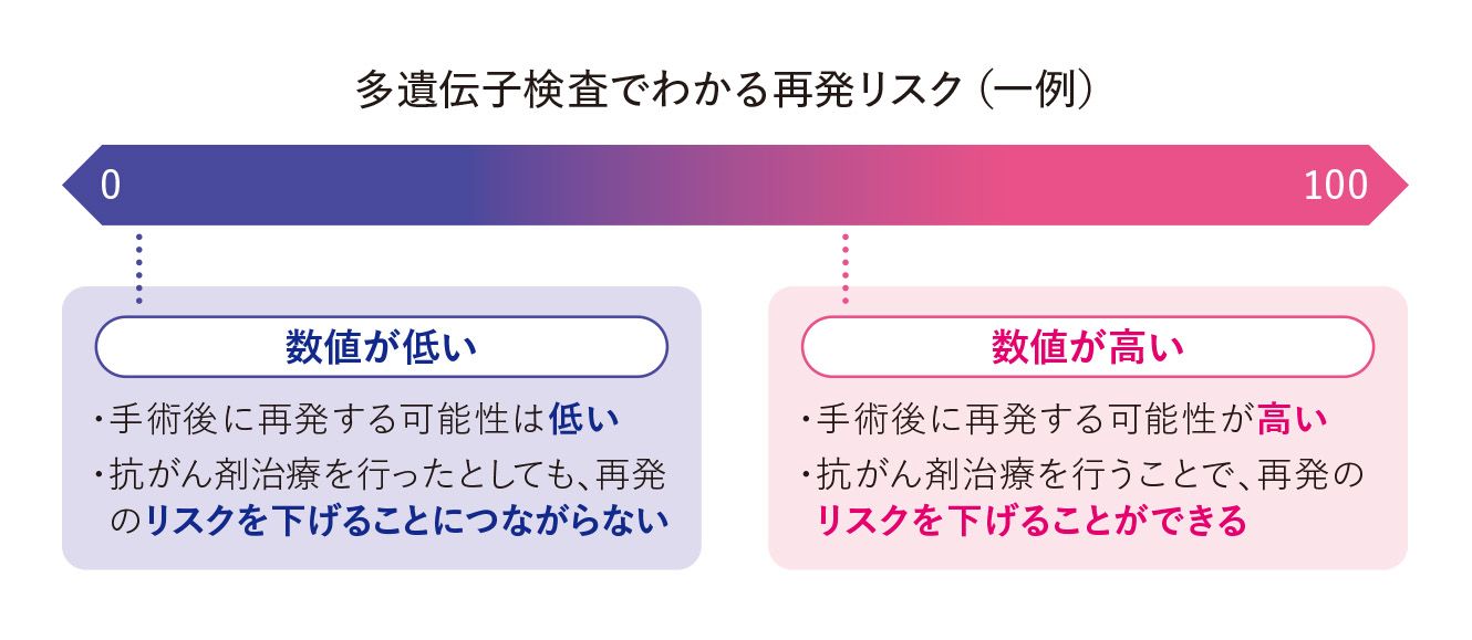──乳がんの専門医に聞きました──抗がん剤治療のメリットがあるか否