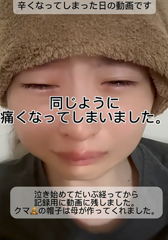 抗がん剤治療中の様子／うーたんさん提供