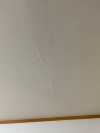 翌朝はふくらみがおさまっていたものの…（独身くそおばさん提供）